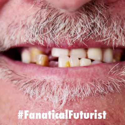 Futurist_teethregen